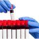 Serology